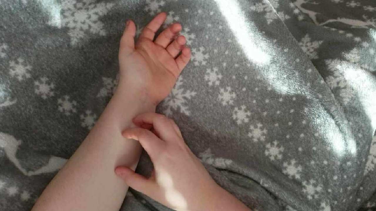svrbenie alergia_2